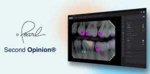Pearl AI Second Opinion